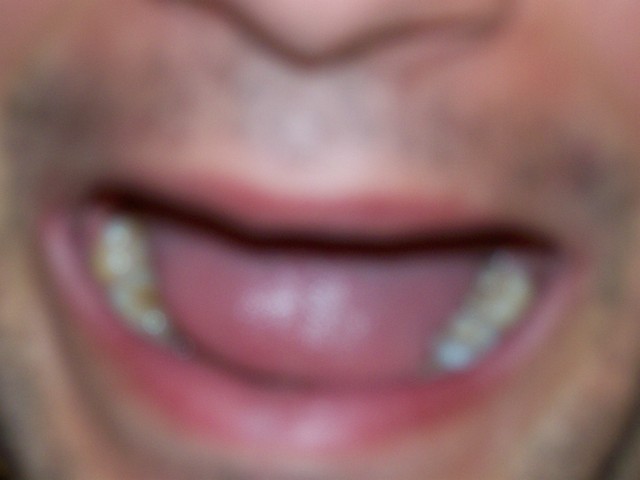 100_2611.jpg